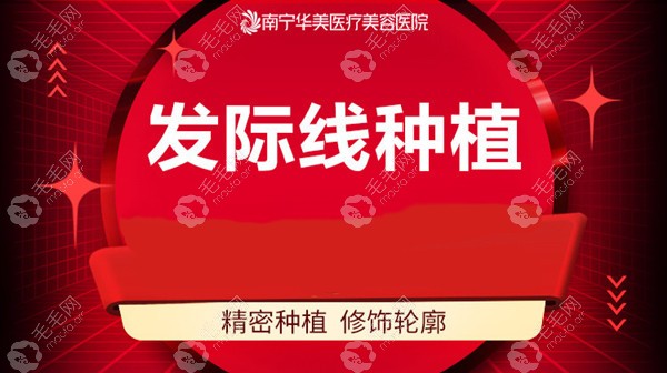 选择南宁华美植发多少钱,现微针加密植发2000单位只要……