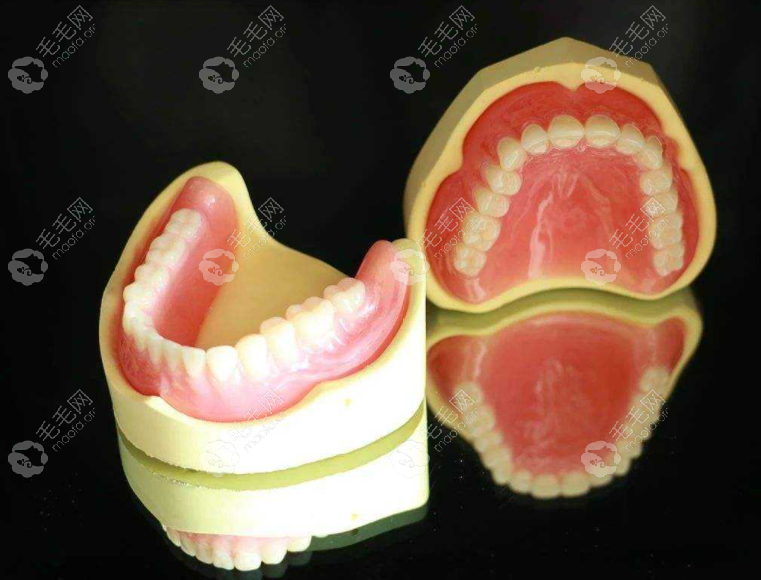 满口牙缺失做一口吸附性义齿要多少钱