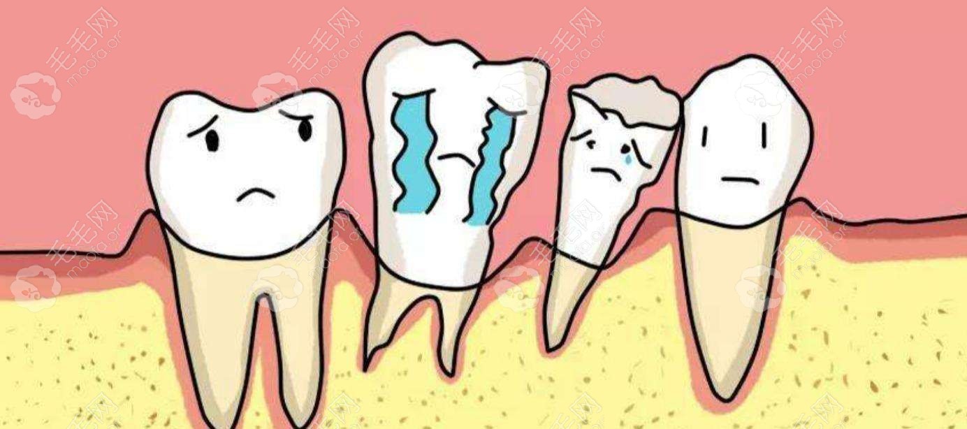三十岁牙周炎全口假牙:重度牙周炎导致我牙龈萎缩不想活