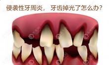侵袭式牙周炎导致牙都掉光了?全口义齿和种植牙都可挽救你
