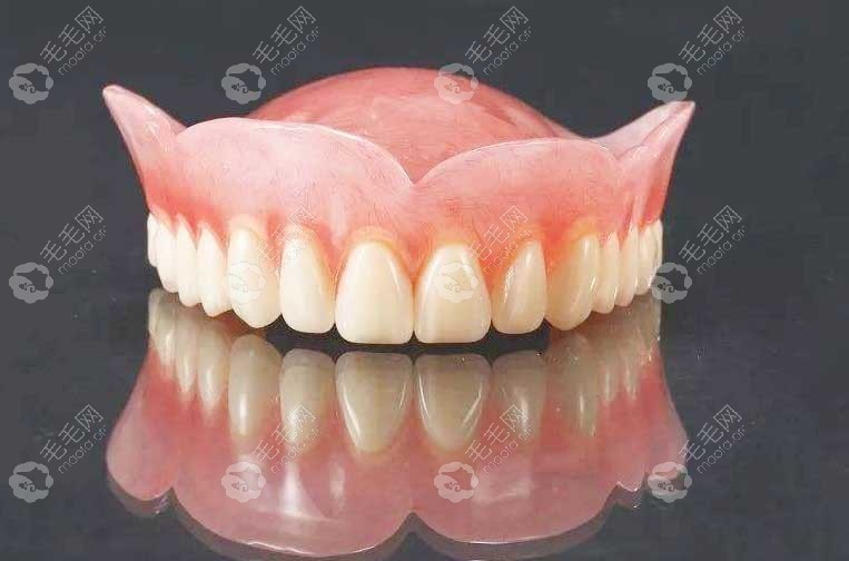 无种植仿生牙就是假牙的一种