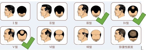 广州荔医的头皮养护项目