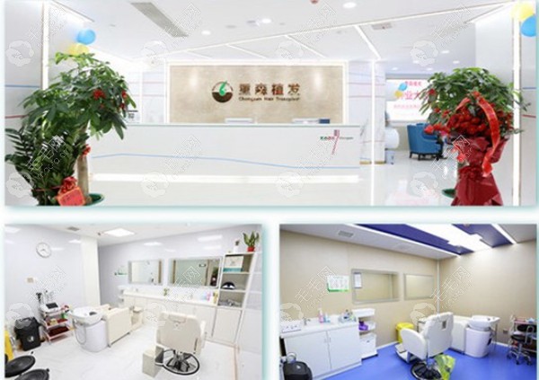 福建植发哪里便宜(福州植发一般多少钱)