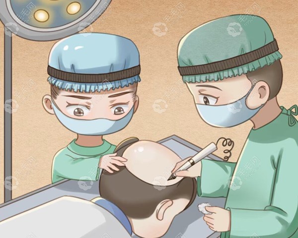 秃顶植发手术的术中种植过程趴下好长时间