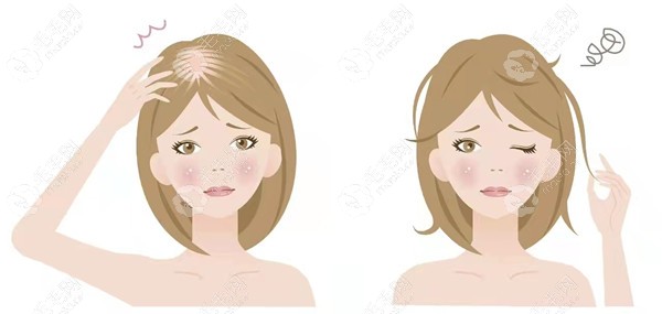 女性脂溢性脱发怎么治疗更有效