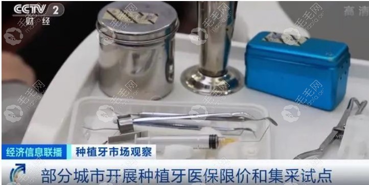 浙江宁波市医 保局开展种植牙集采和纳入医 保保工作