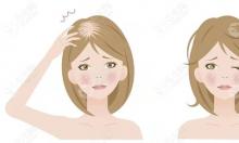 女性脂溢性脱发怎么治疗更有效?不同阶段秃发治疗方法不同