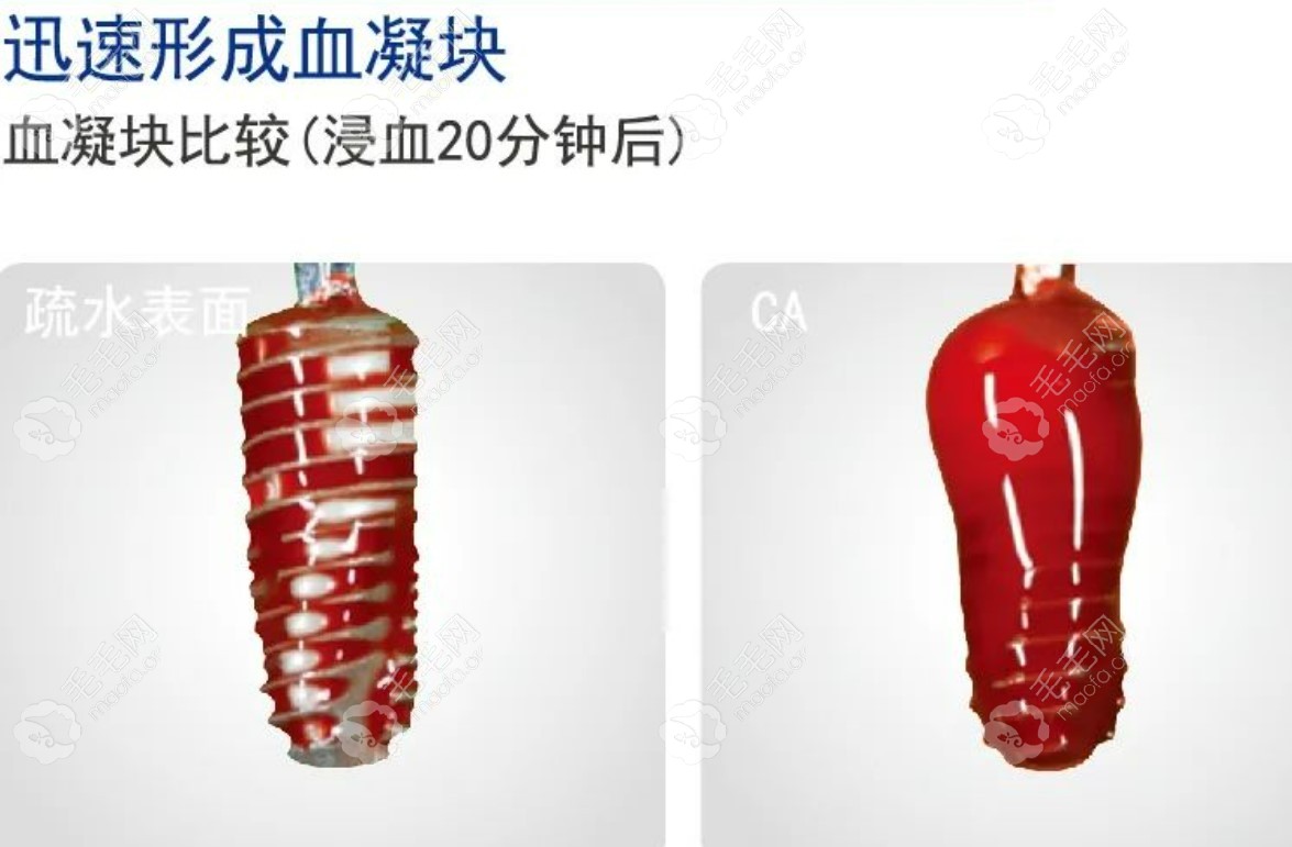 韩国奥齿泰TS3 CA亲水型种植牙优点