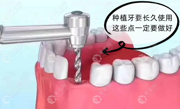 单颗、多颗牙缺失后牙龈萎缩厉害可以种植牙齿吗