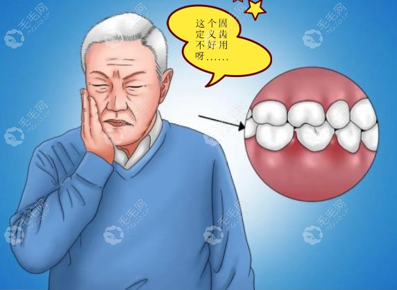 后悔做固定义齿,若将固定假牙换成没有挂钩的活动假牙可好?
