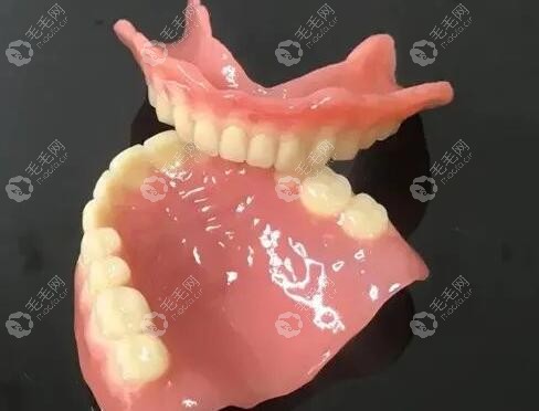 仿生牙不用种植如何固定?它和种植牙/活动假牙固定方法不同