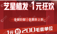 杭州艺星植发1500单位价格不同,源于FUE和NSE不剃发技术有区别