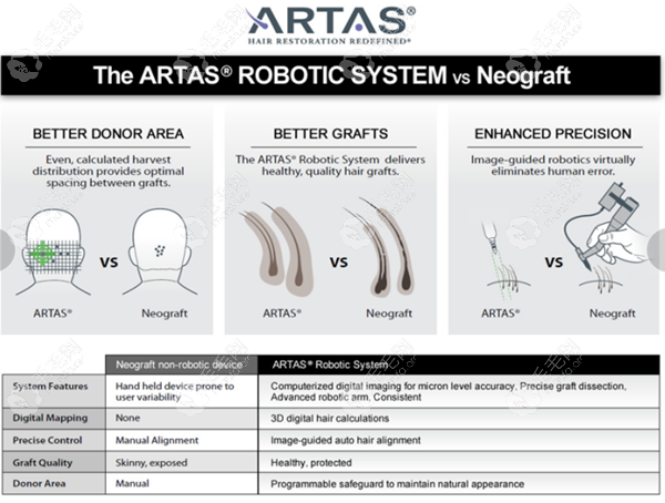 新生ARTAS机器人植发