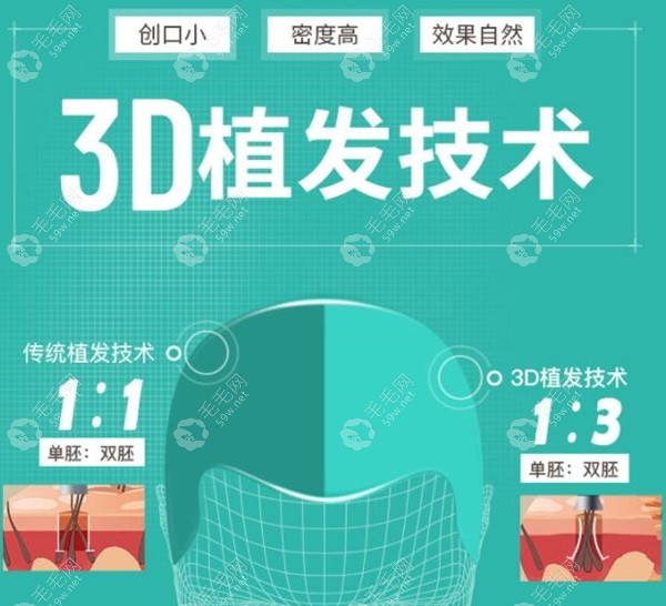 惠州新生3D植发技术的优势：