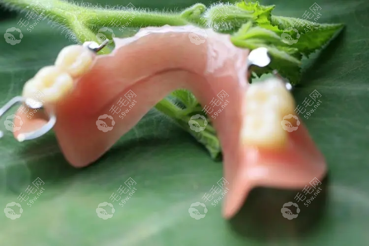 树脂假牙和塑料假牙的区别