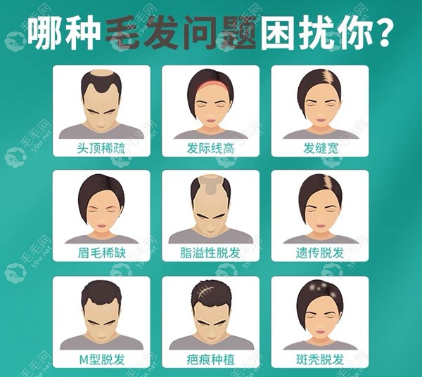 上海比较好的正规植发医院名单来了