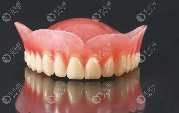 半口吸附性义齿实物图