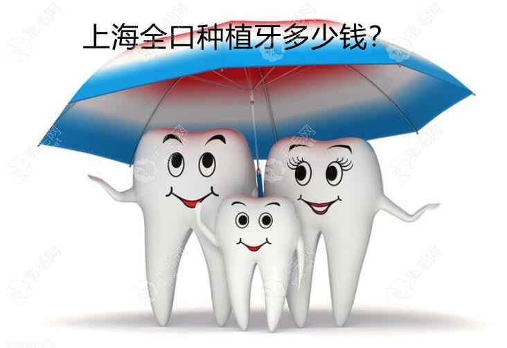 上海全口种植牙收费价目表:含即刻/微创/all-on-4全口假牙价格