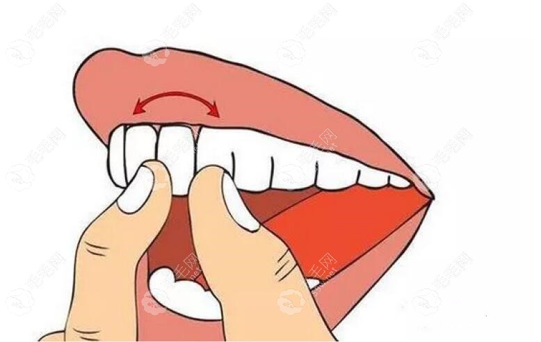 牙齿松动一度二度三度怎么区分?牙齿松动视频来教你辨别