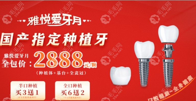 上海雅悦齿科种植牙价格表