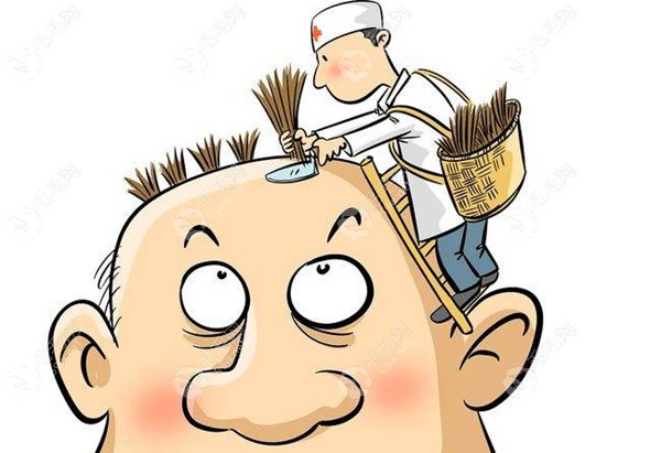 福州正规毛发专科医院排名:知晓有哪些做植发手术比较好