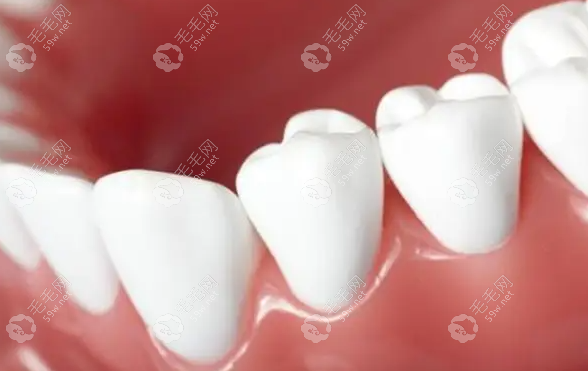 种植体周围的牙龈组织