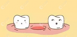 牙没了一定要种牙吗?不一定,镶牙、吸附性义齿都可修复