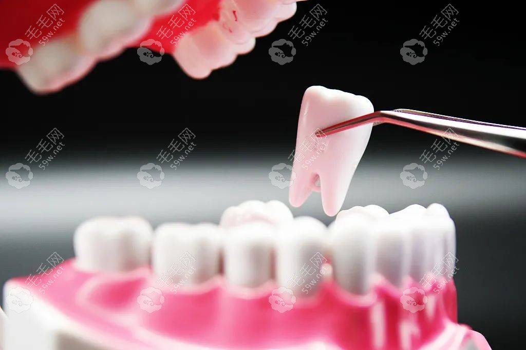 广州海珠区口腔医院价目表-种植牙/整牙/镶牙价格一样不少