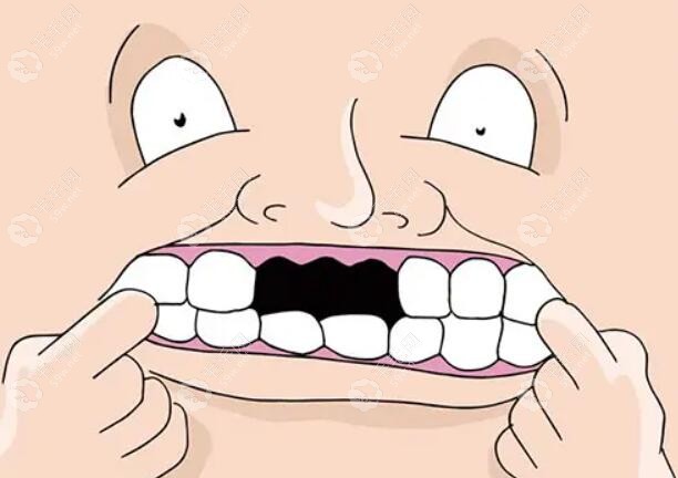 老人拔牙后多久可以装假牙?是一星期/三个月还是六个月呢