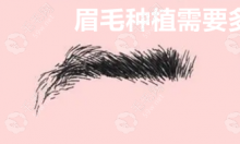 眉毛种植需要多少毛囊单位?男/女士植眉需要的毛囊数量不等