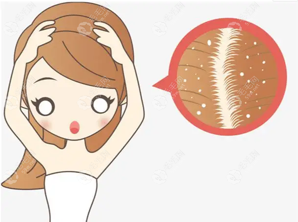 滋养头皮毛囊系列的洗发水