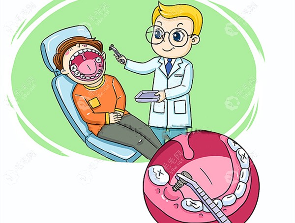 河南省常规种植牙医疗服务限价4300元一颗