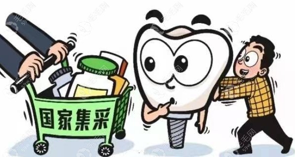 青岛市口腔医院种植牙集开始实施