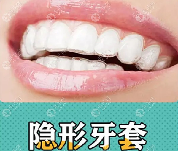 广州隐形牙套价格：1.9-5万元左右