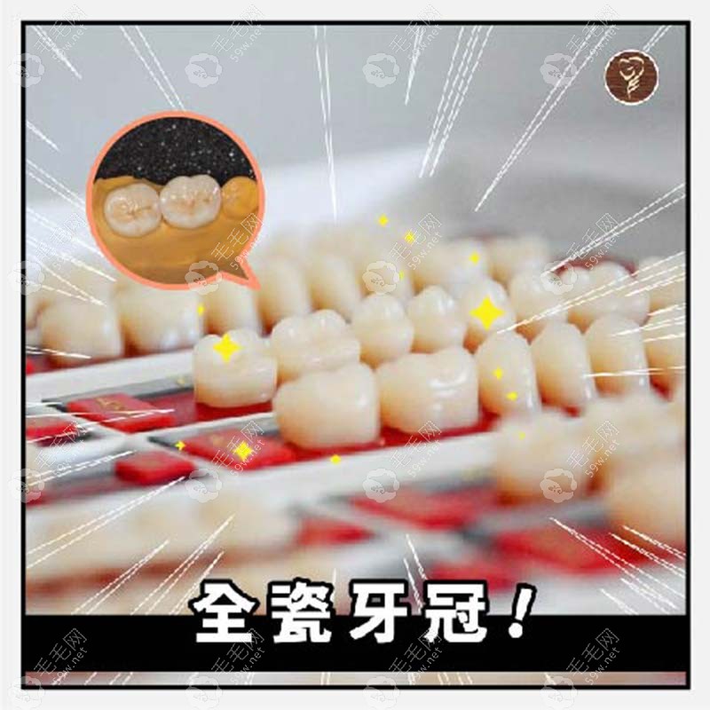 中诺口腔医院全瓷牙价目表59w.net