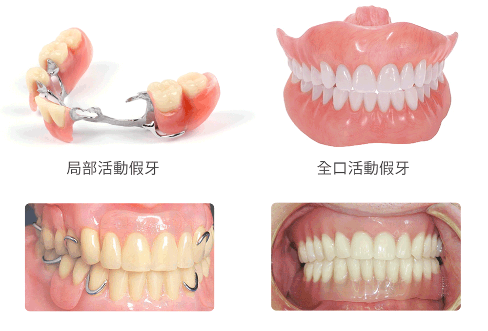 陈晓莉医生做种植牙技术优势59w.net