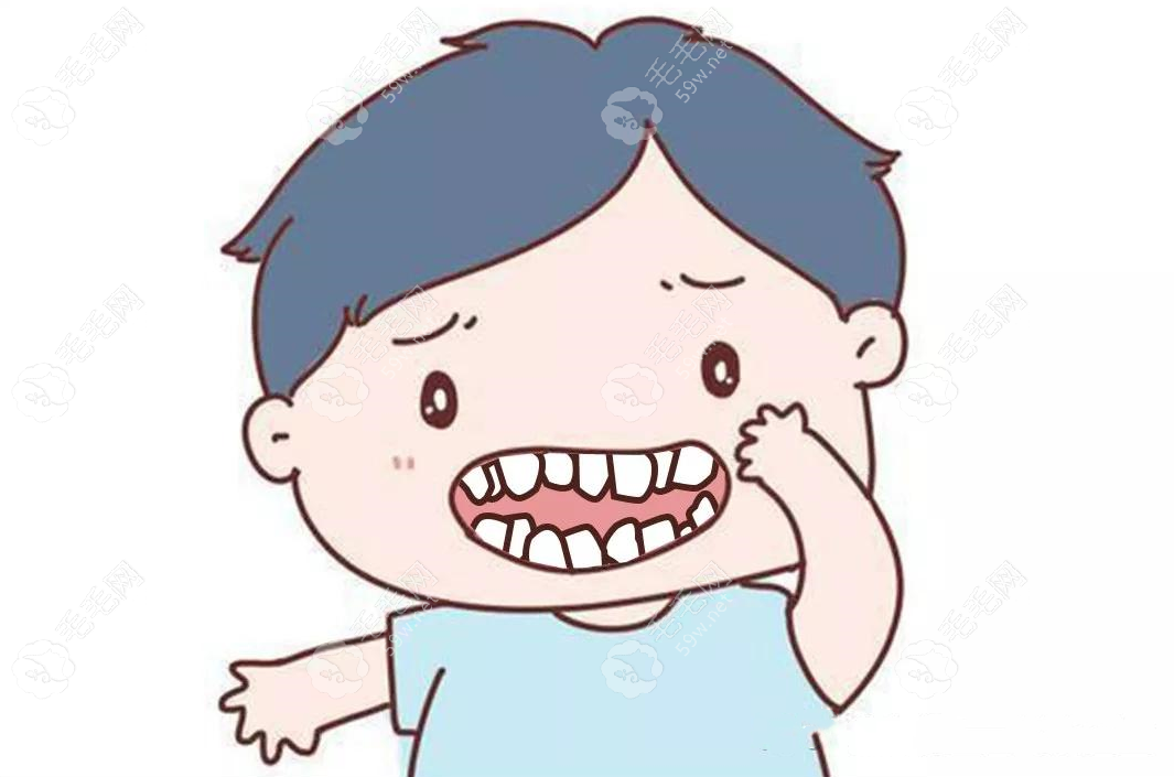儿童龅牙早期干预有必要吗