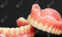 西安活动义齿价格多少,西安一口假牙一般需要2k-3w元左右