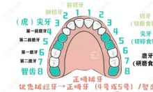 为什么正畸都是拔4号牙?拔4号牙和5号牙对脸型影响的区别