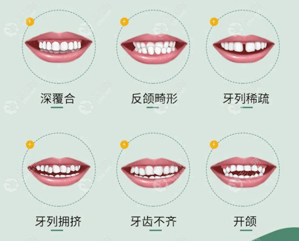 可矫正的牙齿类型 59w.net