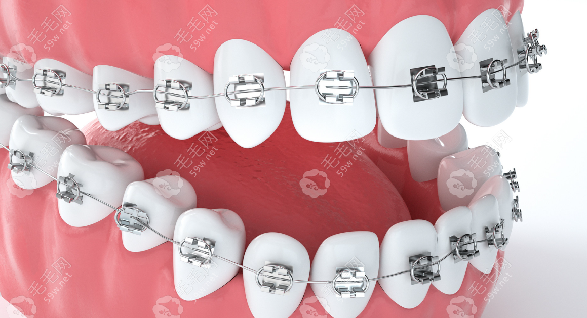 连云港市牙科医院整牙价格表,金属正畸7k+/隐形矫正牙齿1.8-5w