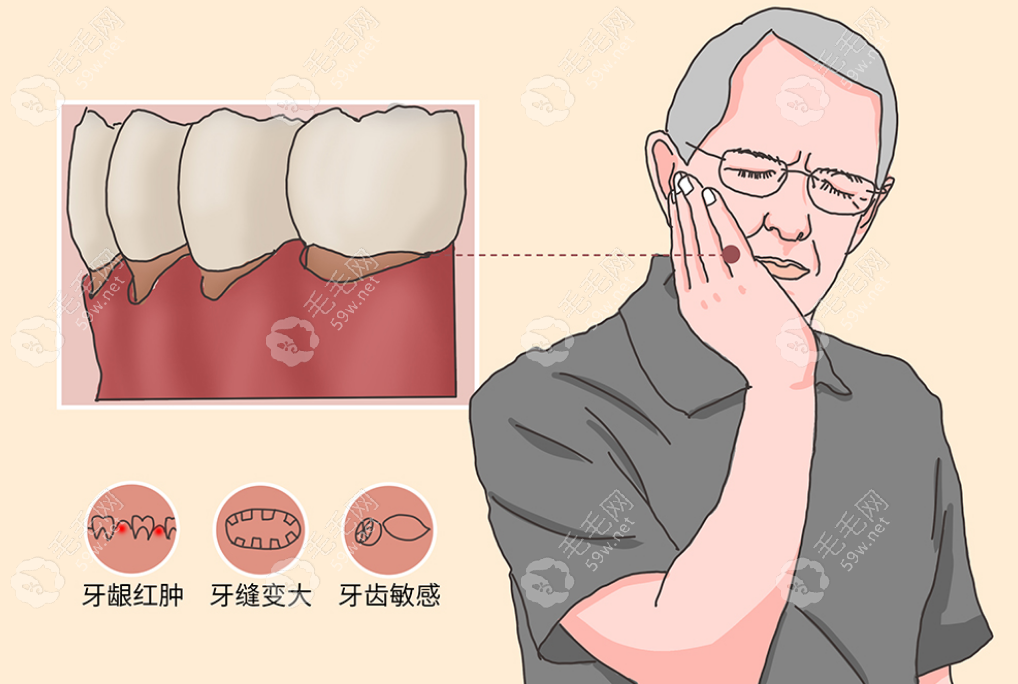 牙结石导致牙龈萎缩牙齿松动怎么治疗