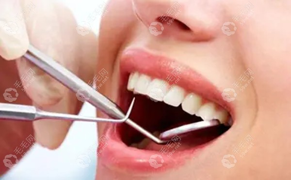 南京口腔医院装全口假牙价格公示:活动假牙2k+/满口种植牙8w+