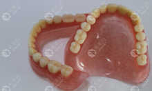 南京口腔医院装全口假牙价格公示:活动假牙2k+/满口种植牙8w+