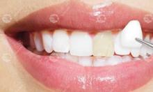 牙齿发黄怎么可以变白?牙齿黄了超简单的变白方法-做牙贴面