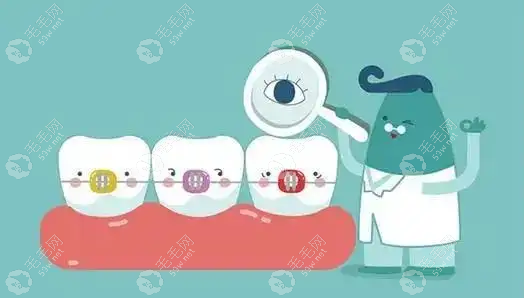 滁州牙齿矫正整个过程要多少钱?拔牙,戴牙套,保持器一般1w+