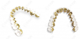 3m黄金舌侧矫正多少钱?这款牙套是黄金做的价格较高,在8-10w+
