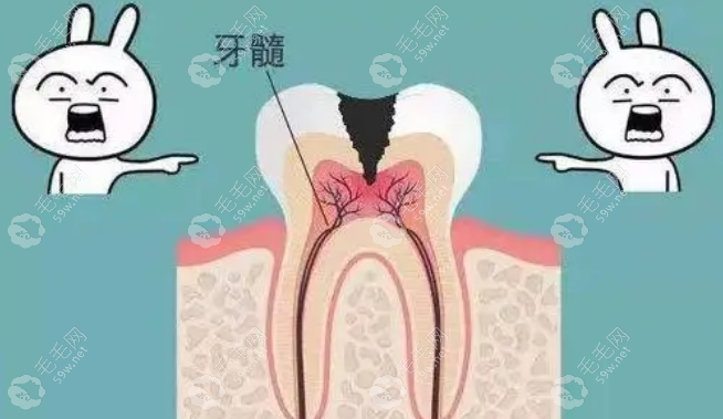 乳牙什么情况需要根管治疗牙齿？