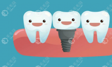 张家界牙科收费价格表新版:价位标准为种植牙2k+/矫正牙5k+