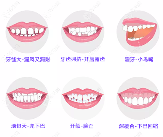 郑州牙齿矫正好的医院矫正牙齿多少钱